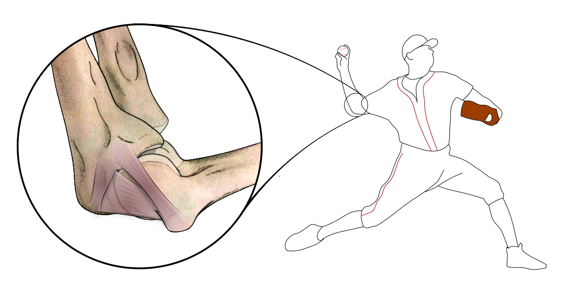 Ulnar Collateral Ligament